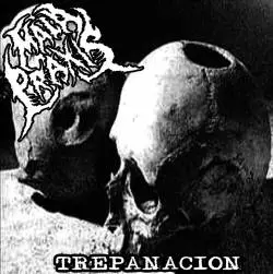 Trepanación
